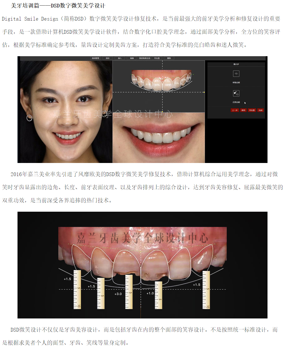 美牙培训课程-dsd数字微笑美学设计_广州美牙培训_牙齿美白培训_嘉兰